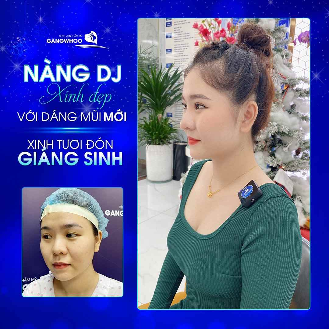 Thăng cấp dáng mũi giúp bạn nâng tầm sắc đẹp