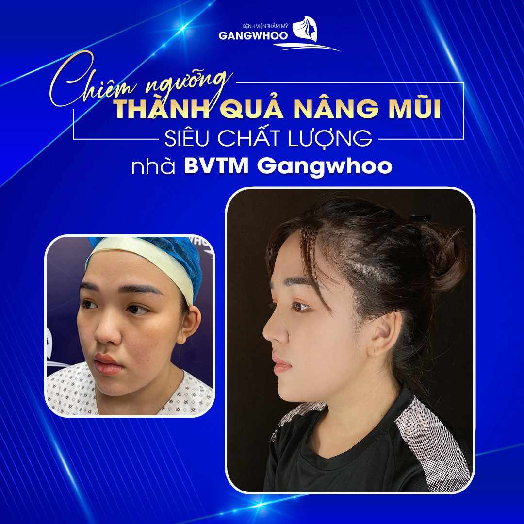 Dáng mũi chất lượng đến từ Gangwhoo