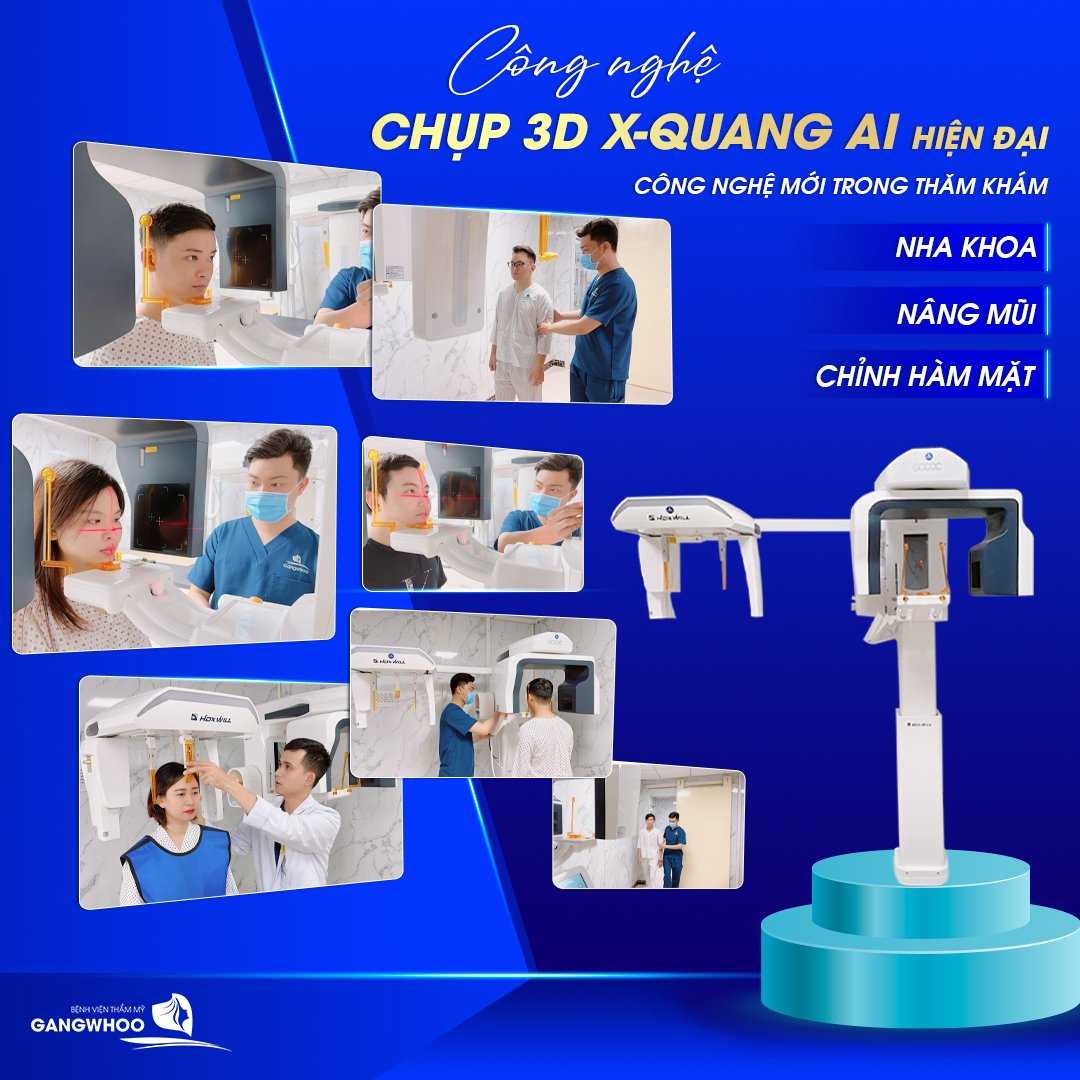 Công nghệ chụp phim bằng máy X-quang AI điện toán