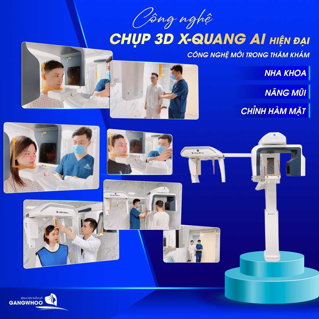 Ứng dụng công nghệ máy chụp X-quang AI điện toán thông minh trong thẩm mỹ hàm mặt