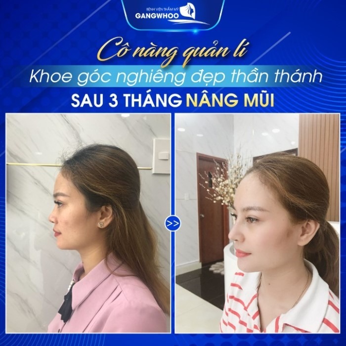 Hãy tìm cơ sở thực hiện để có được kết quả tốt nhất