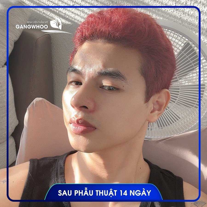 chăm sóc sau phẫu thuật