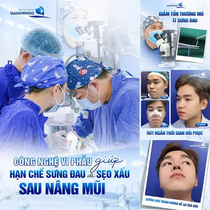 Cập Nhật Xu Hướng Tại 3 Cơ Sở Nâng Mũi Ở Đắk Nông