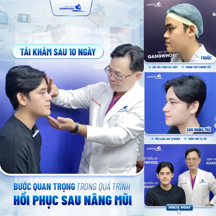 Nâng Mũi Ở Đồng Tháp Có Gì Hot? Top Cơ Sở Giúp Bạn “Lên Hương” Ngoại Hình