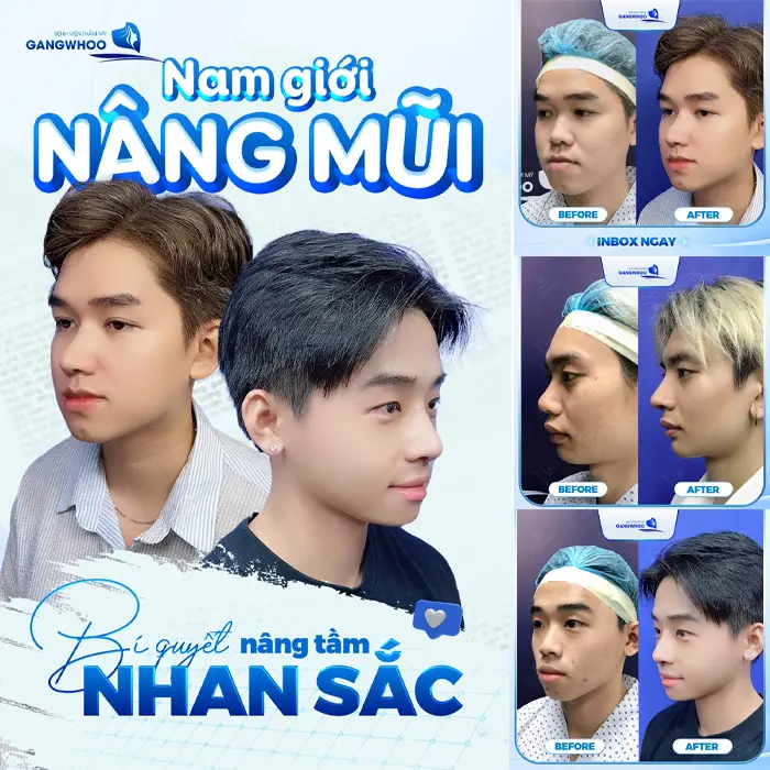 Bật Mí 2 Địa Chỉ Nâng Mũi Ở Nam Định Giúp Bạn “Lột Xác” Ngoạn Mục!
