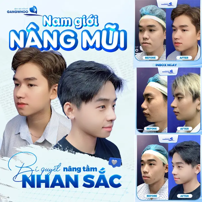 Nâng Mũi Ở Ninh Thuận – Đâu Là Lựa Chọn Giúp Bạn Đẹp Như Idol?