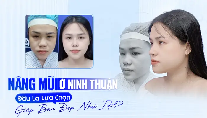 Nâng Mũi Ở Ninh Thuận – Đâu Là Lựa Chọn Giúp Bạn Đẹp Như Idol?