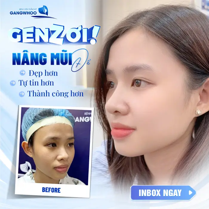 Nâng Mũi Ở Ninh Thuận – Đâu Là Lựa Chọn Giúp Bạn Đẹp Như Idol?