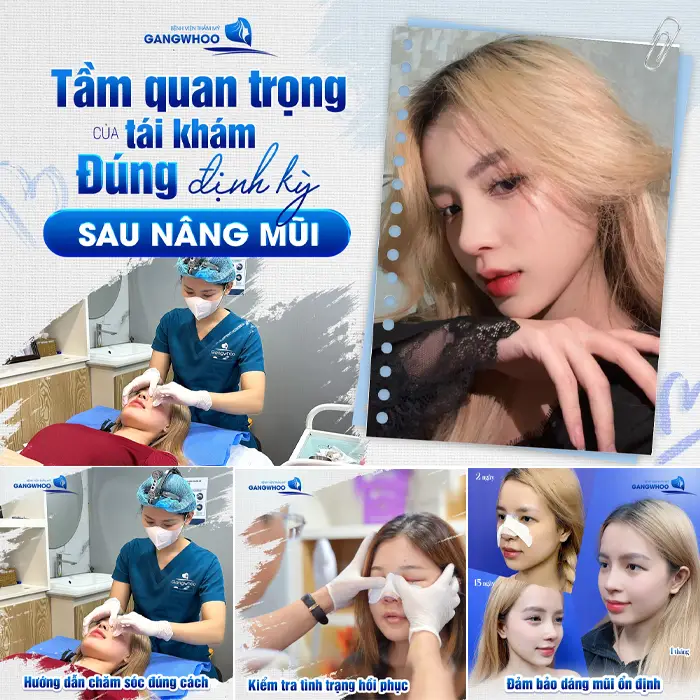 Nâng Mũi Ở Ninh Thuận – Đâu Là Lựa Chọn Giúp Bạn Đẹp Như Idol?